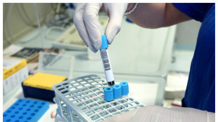 Malattie rare, 100 progetti per bando Aifa ricerca indipendente