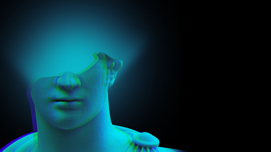 Mal di testa cronico, nuovo farmaco dimezza gli attacchi