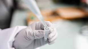 ++ Emofilia B, primo italiano curato con terapia genica ++