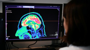 Un implante cerebral convierte los pensamientos en habla casi en tiempo real
