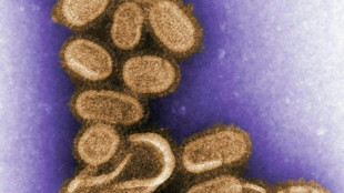 La grippe saisonnière, possible descendante directe de la grippe "espagnole"