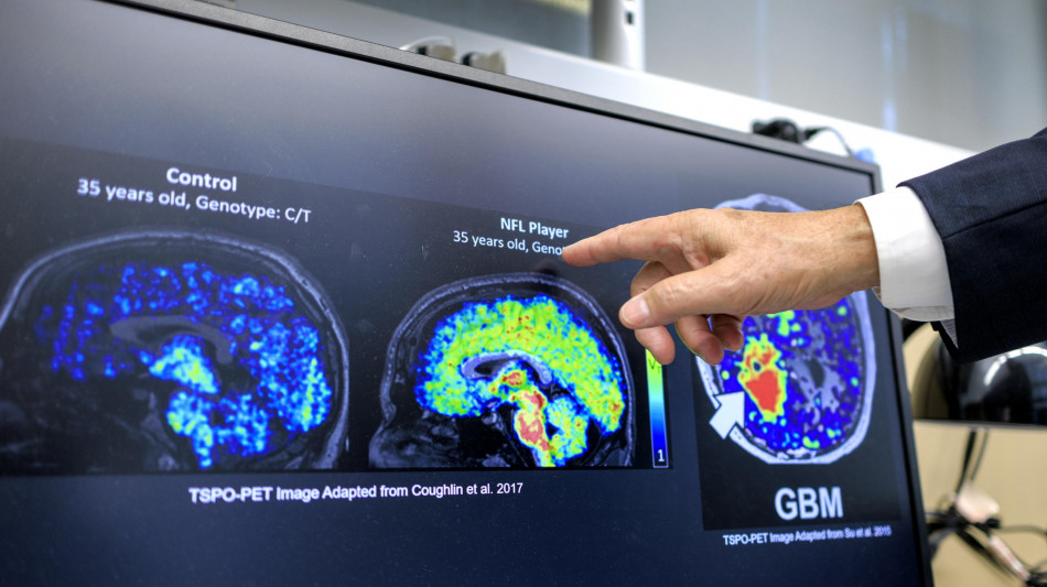 Da adeguato riposo a sfide per la mente, i 10 comportamenti per prevenire le demenze