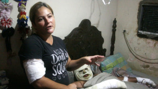 In Venezuela, cars that erupt in flames have drivers on edge